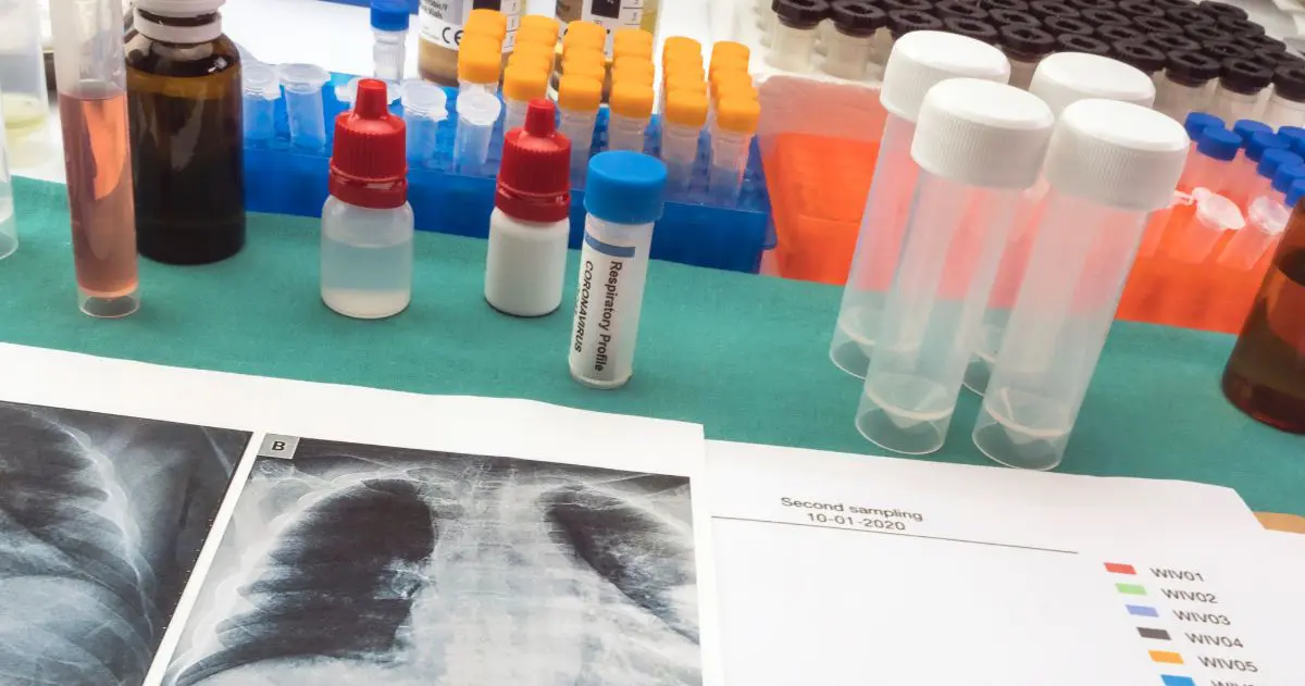 Mensalidade de Análises Clínicas: confira as opções de curso e respectivos valores