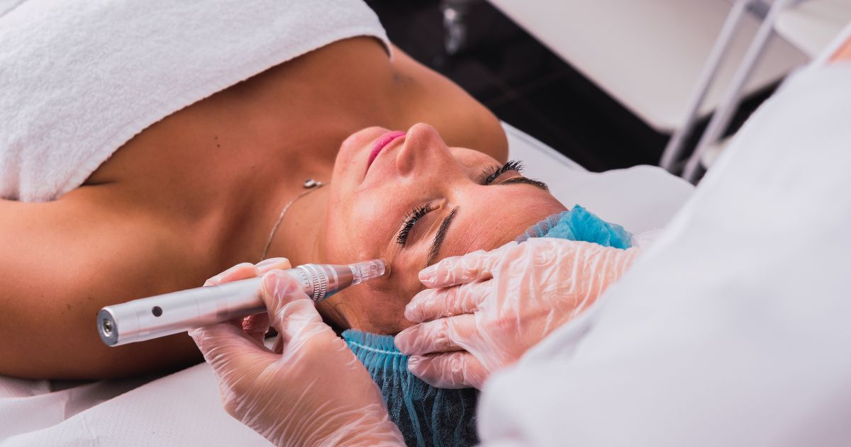 Aprende no Curso Técnico em Estética - Esteticista fazendo tratamento de mesoterapia com dermapen no rosto da mulher
